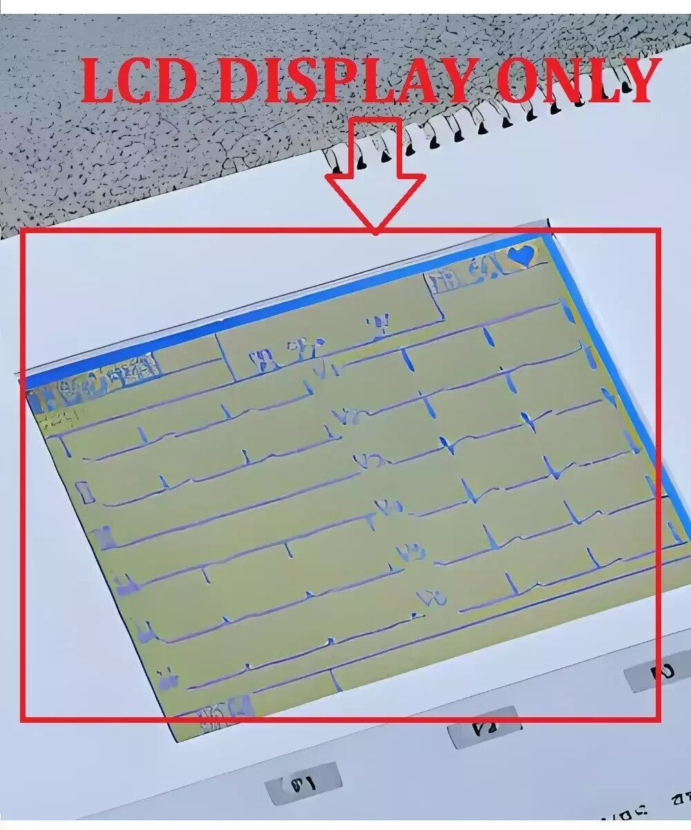 LCD Display For Nihon Kohden Cardiofax GEM ECG-9010P 9020P ECG-9020K ECG-92C